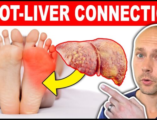 What Your FEET Can Tell You About Your Liver – Surprising Symptoms!