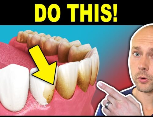 Top 10 Foods for STOPPING Dental Plaque (TARTAR)
